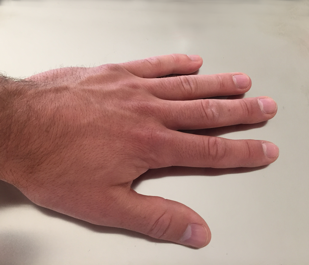Hand touching proximion's FiBER OPTIC SENSORs - Wistheat