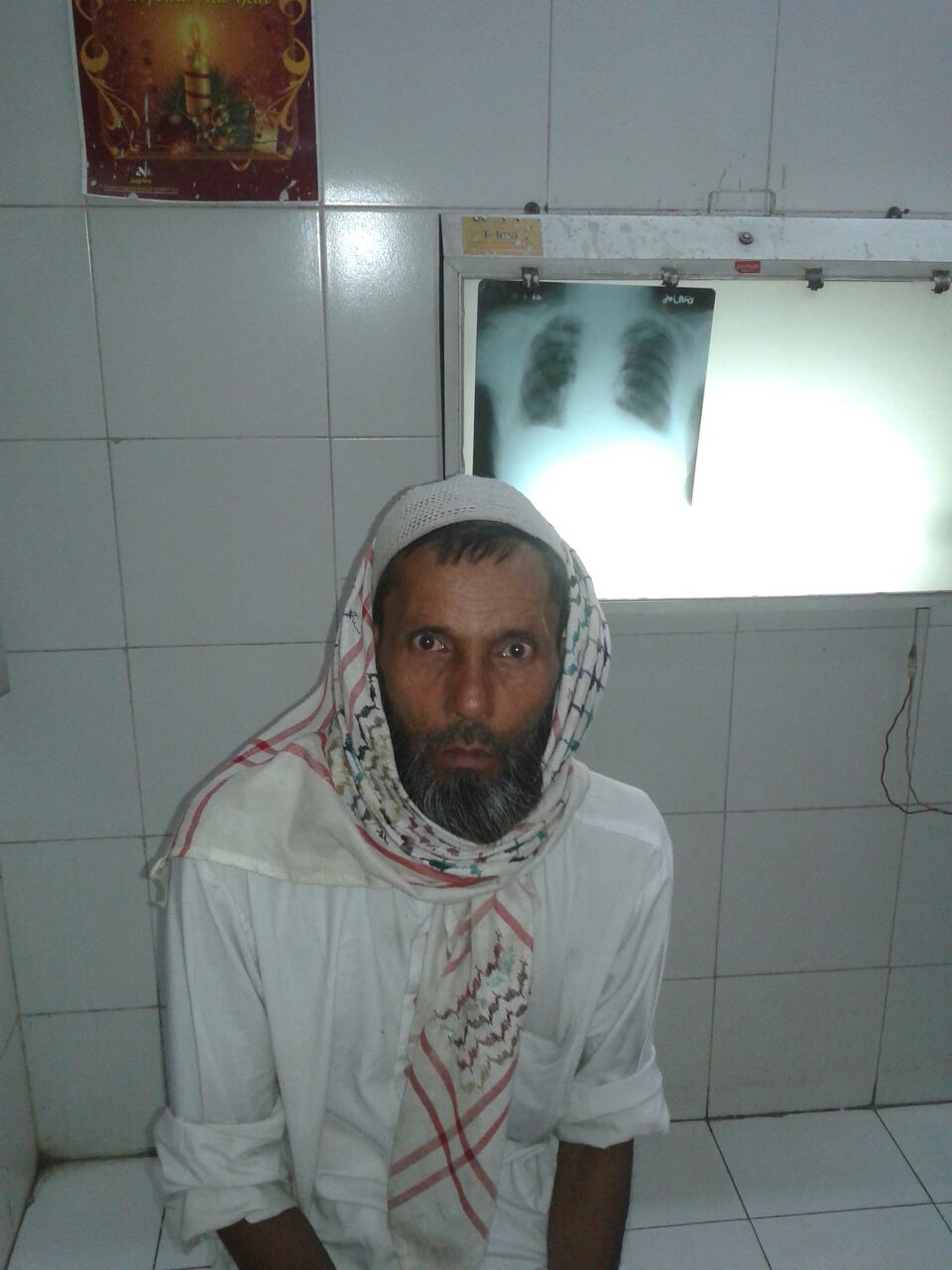 Yakub is 76 years old and suffers from pulmonary tuberculosis. X-rays reveal abnormalities in the left lobe of his lung. He has been having night fevers for the past 3 months and coughing spasms for the past 1 month. He works as a tuk-tuk (an Indian…