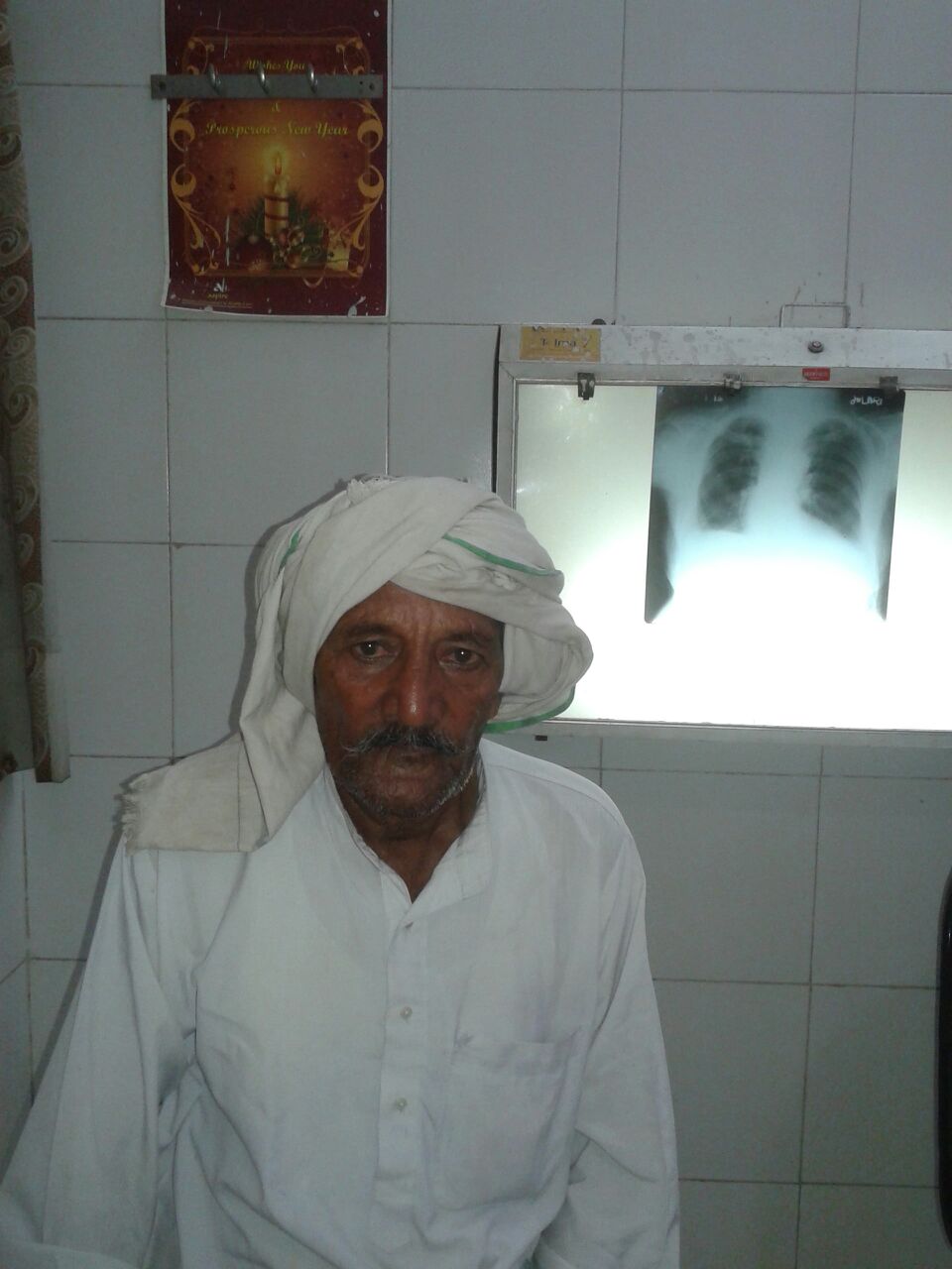 Manzi has tuberculosis. He is 60 years old. His oldest daughter recently got married.