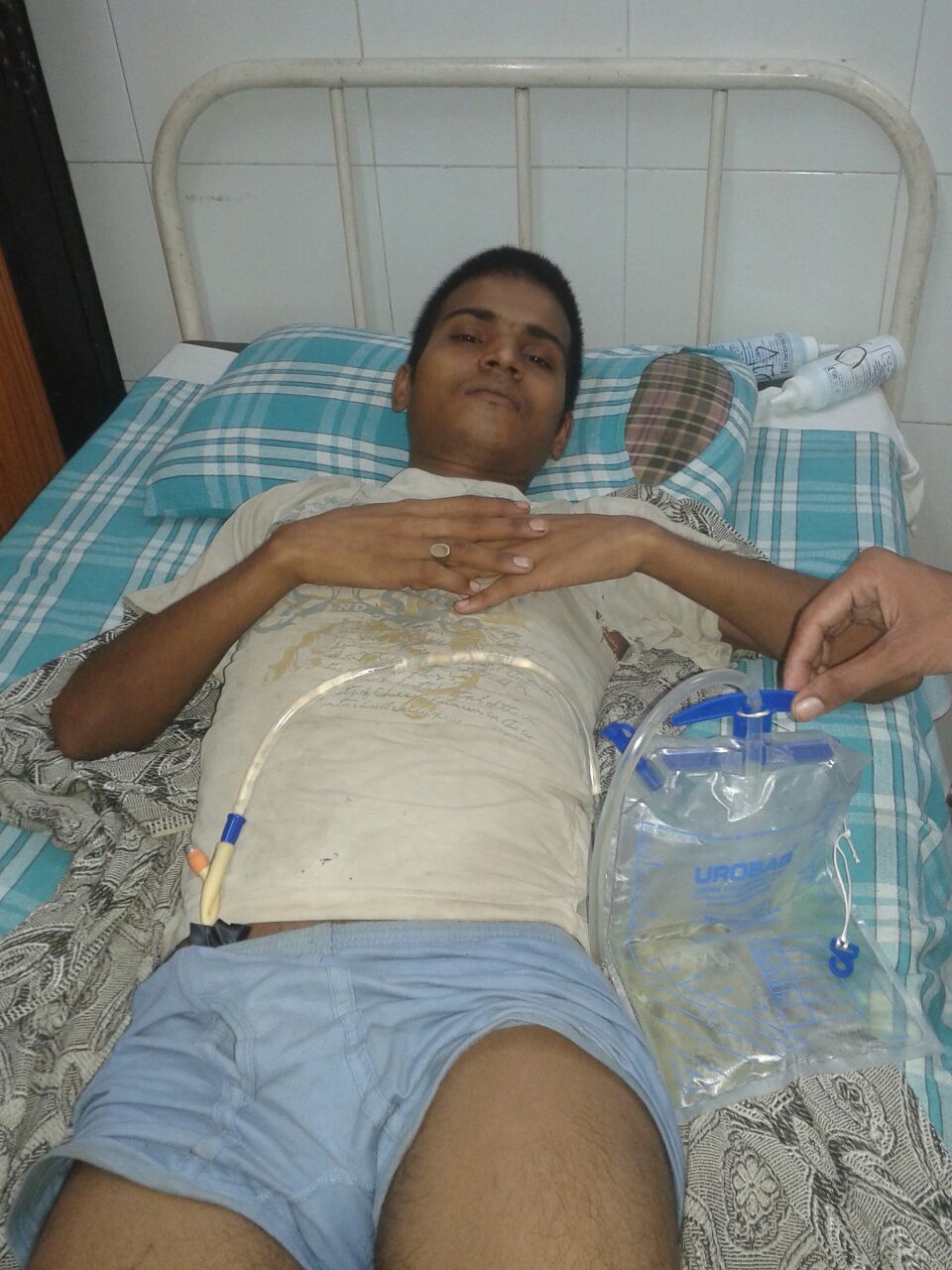 Sanjay is 19 years old and works as a laborer. He fell off of the house he is helping to build and injured his spine. He requires an x-ray.