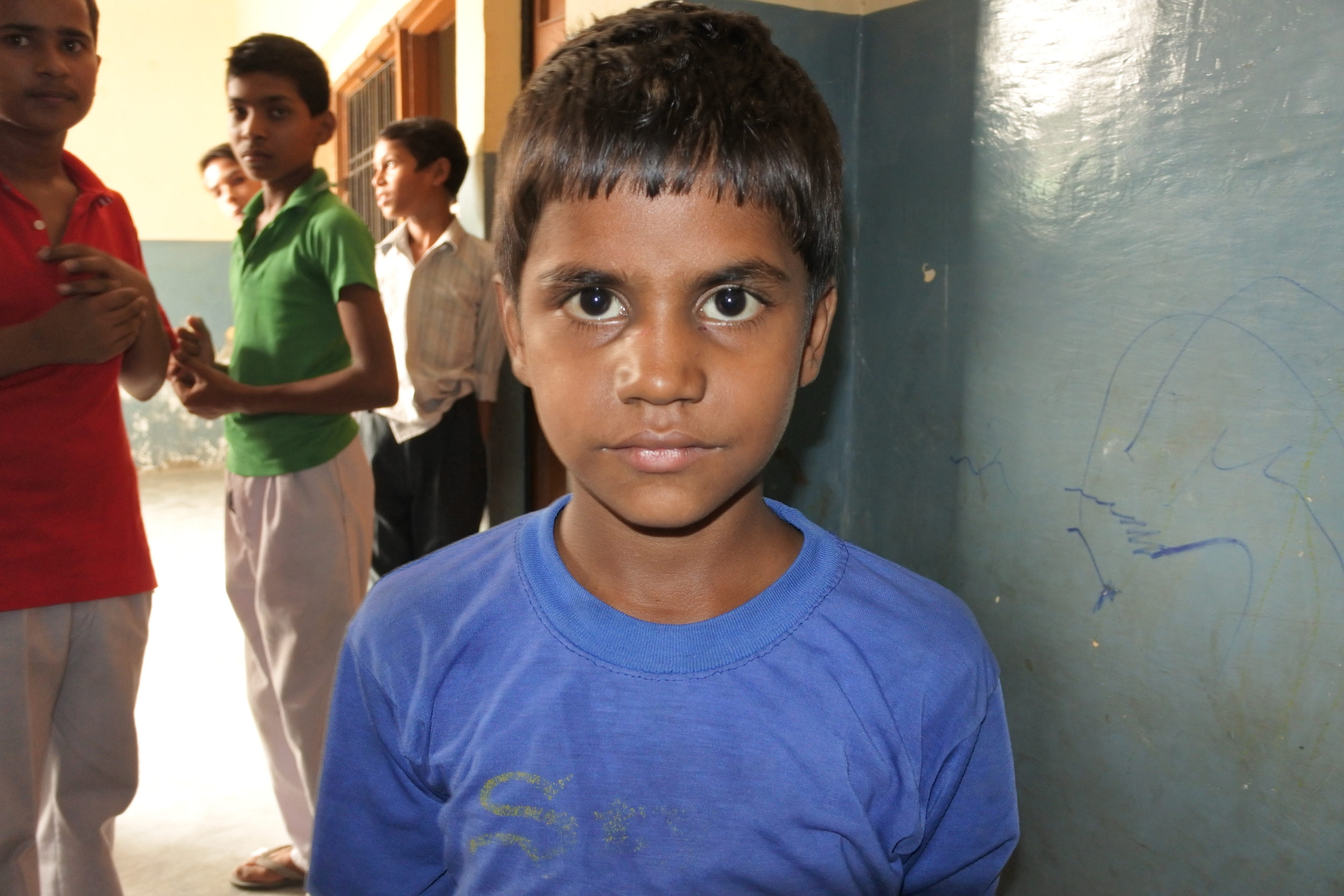 Jogesh is 8 years old. He has had an ear infection for over one ear in his right year. He has started to lose hearing in his right ear. We hope to start him on antibiotics to eliminate the infection. He loves playing cricket and hopes to become a pr…