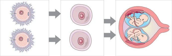 Formation of fraternal (dizygotic) twins. Courtesy Womenshealth.gov