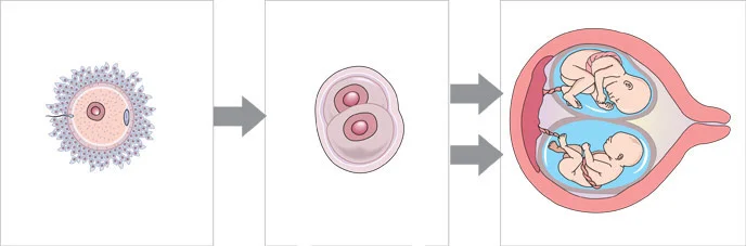 Formation of identical (monozygotic) twins . Courtesy Womenshealth.gov
