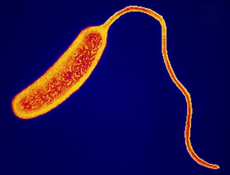 Scanning electron microscope image of V. Cholerae