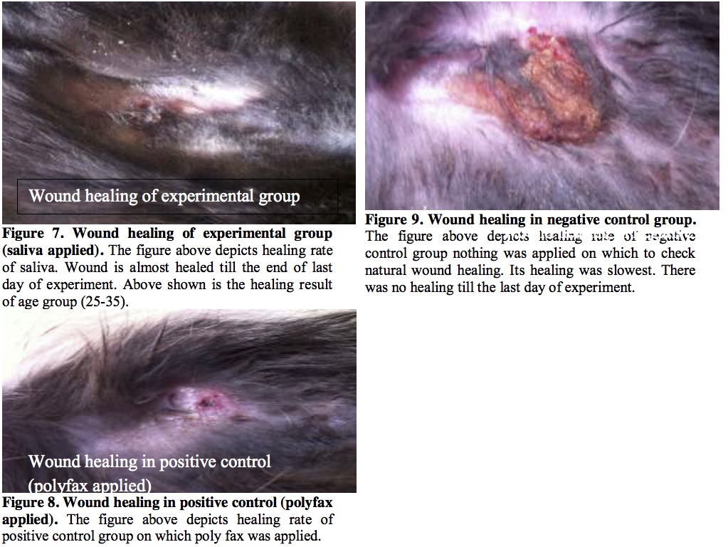 Wound healing properties of saliva, polyfax, and control on induced wounds on the backs of rabbits. From Haq et al. Antimicrobial and Wound Healing Properties of Human Saliva. Int. J. of Pharm. Life Sci. 2016. 7 (2); 4911-4917.