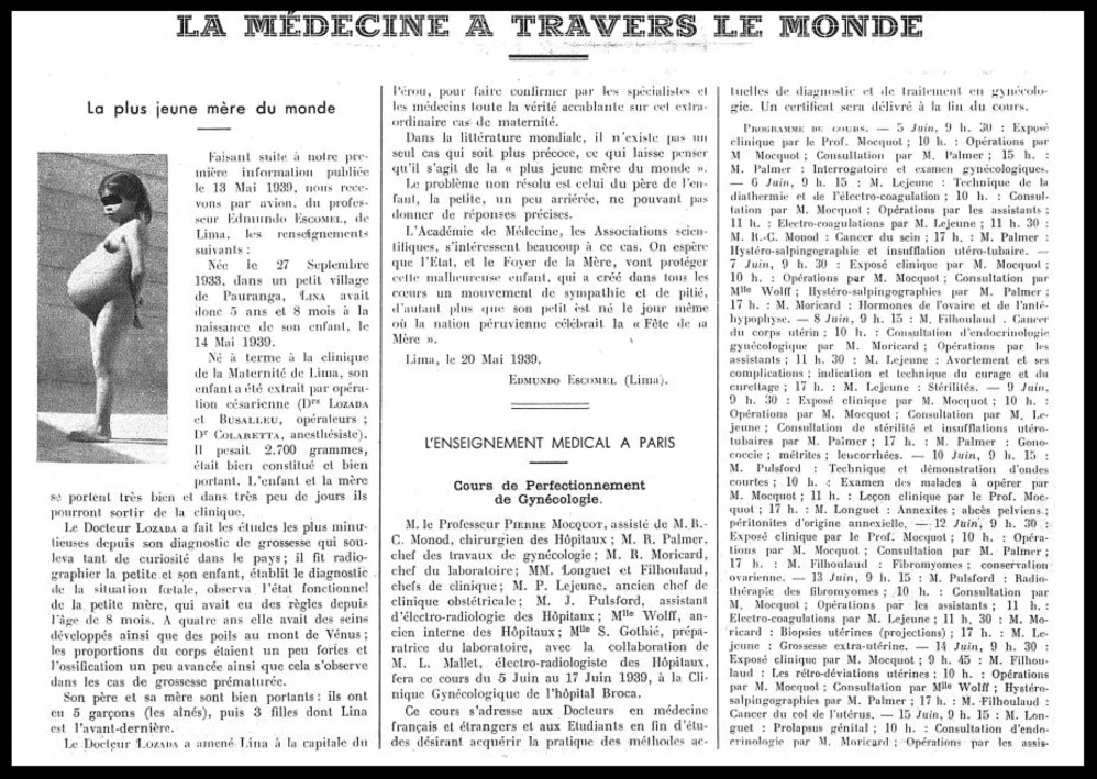 Report from La Presse Medicale , May 31, 1939. The complete original is here .