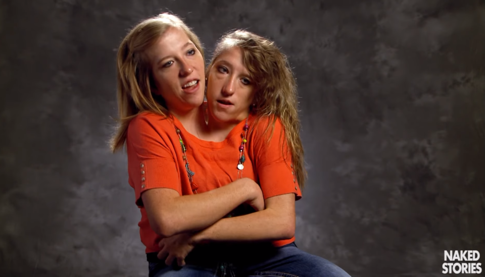 Abby and Brittany Hensel. From here .