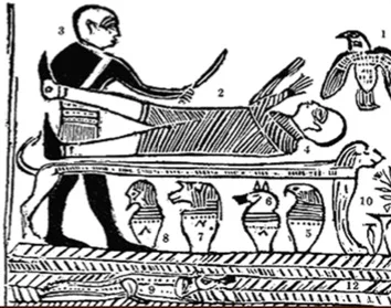 Depiction of amputation in ancient Egypt (Edwin Smith Papyrus, New York Academy of Medicine).