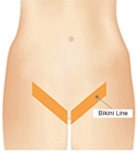 bikini-line.jpg