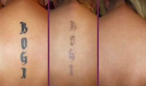 Tattoo Before After 3.jpg