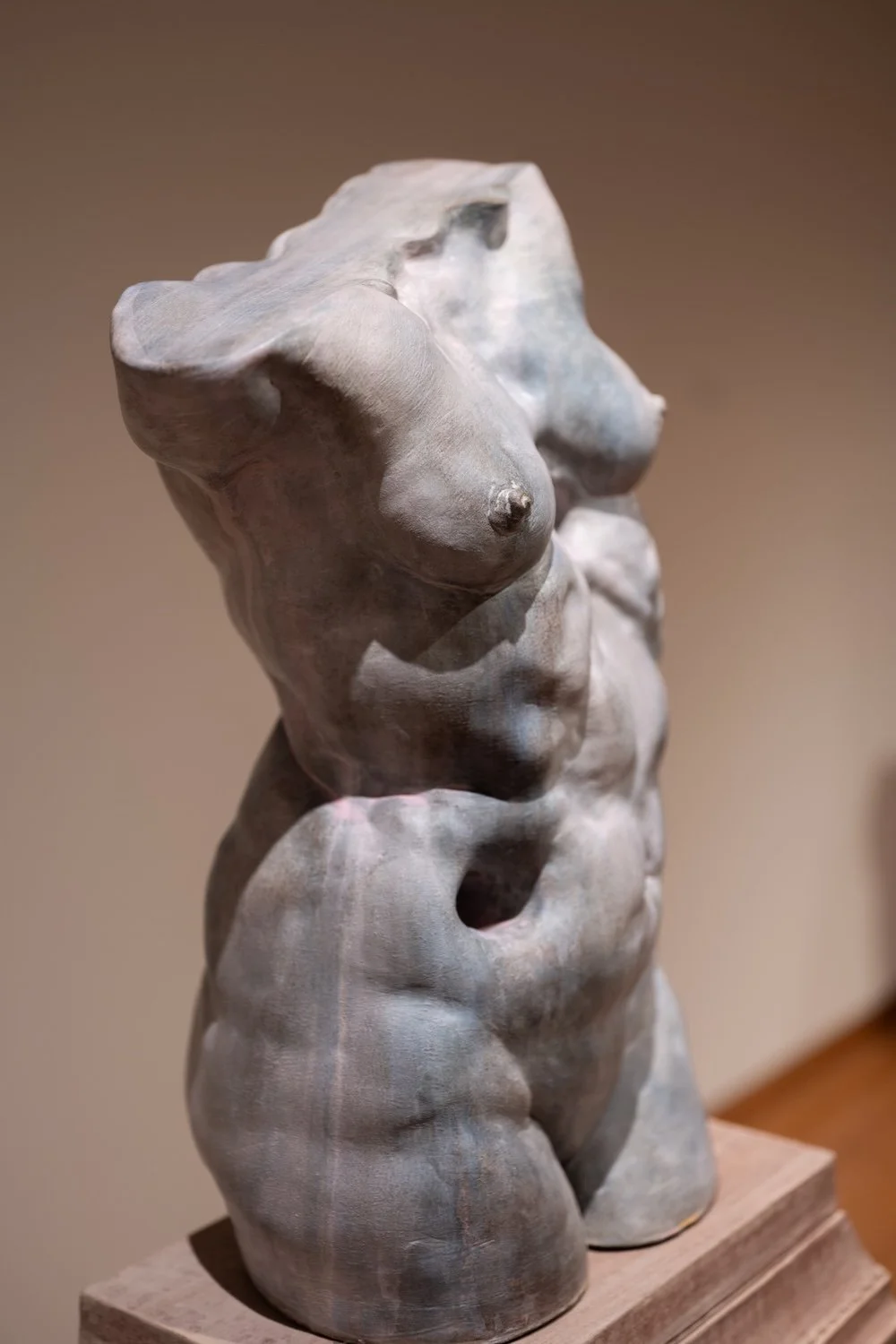 Interstitium II