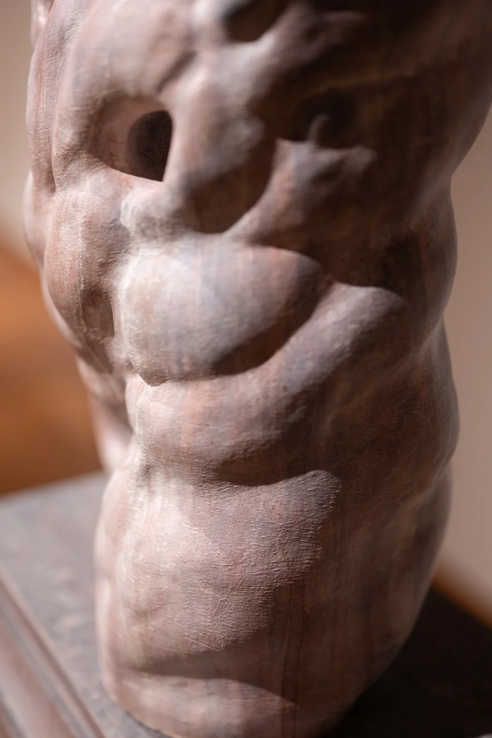 Interstitium I