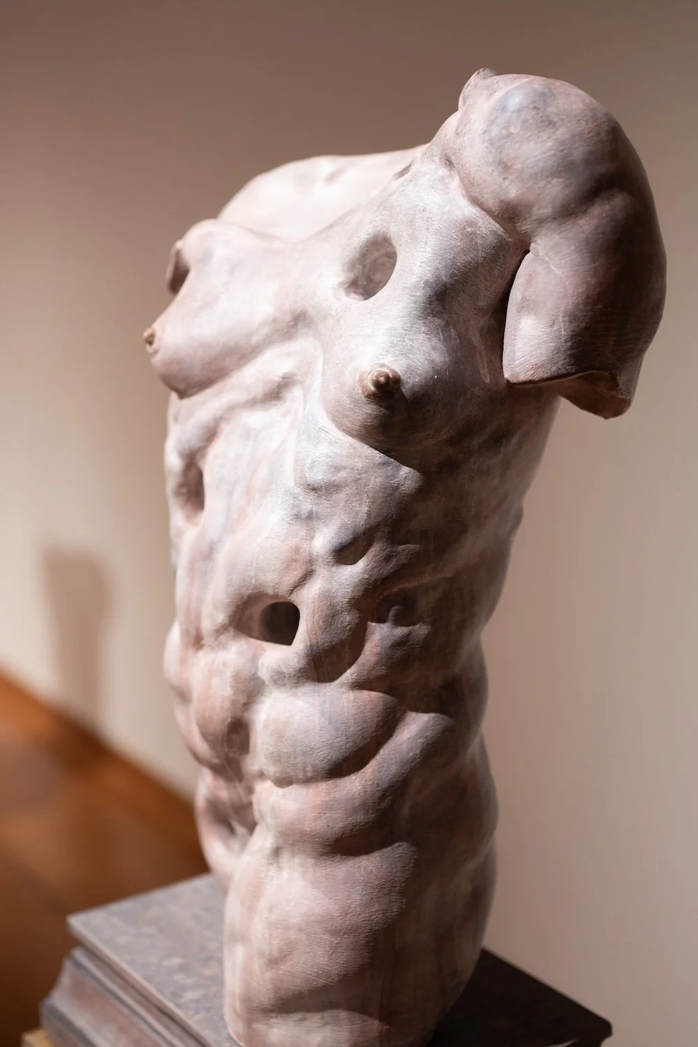 Interstitium I