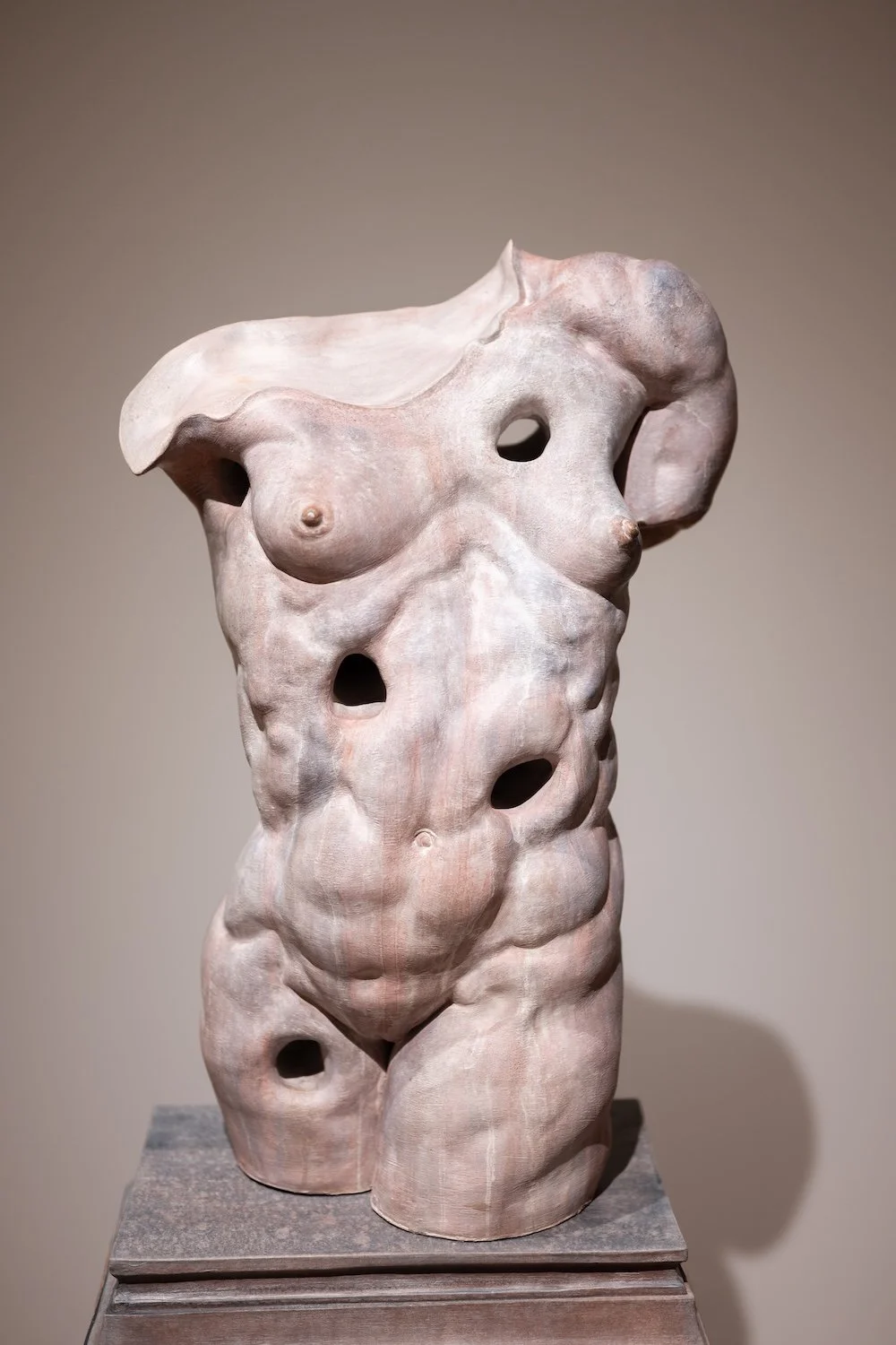 Interstitium I