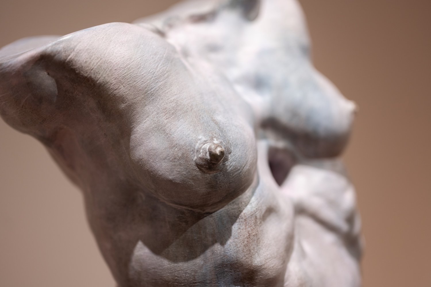 Interstitium II