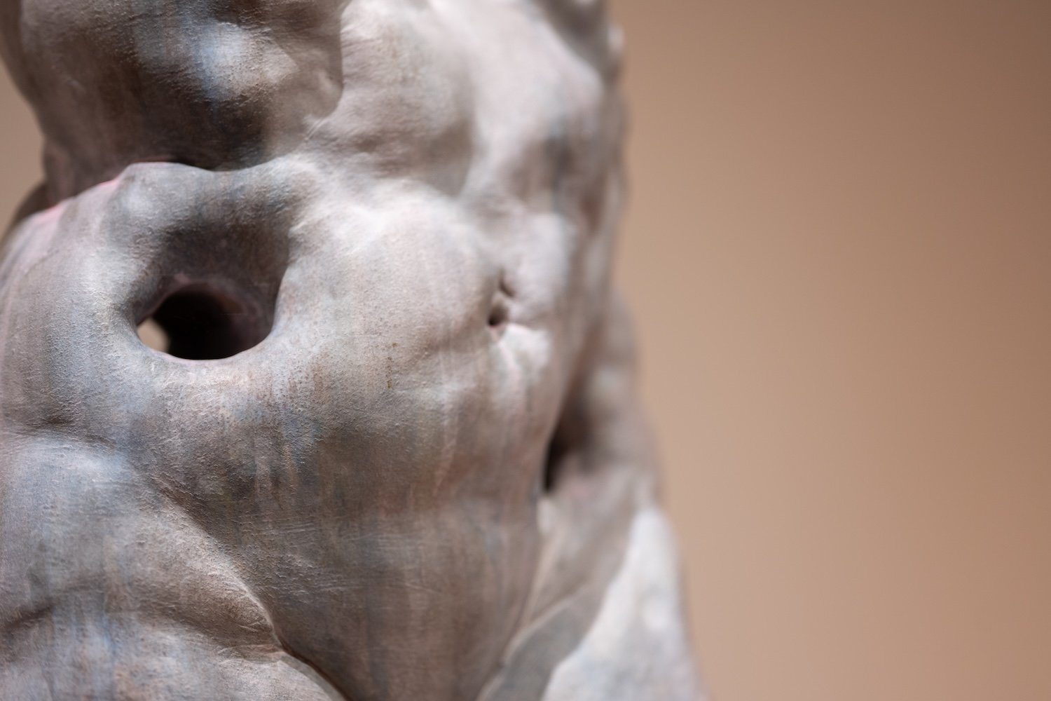 Interstitium II