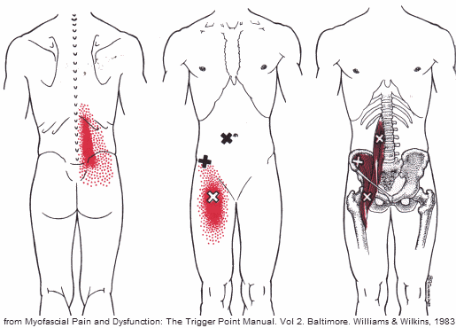 My Back Hurts When I Ride My Bike Revo Physiotherapy Sports Performance