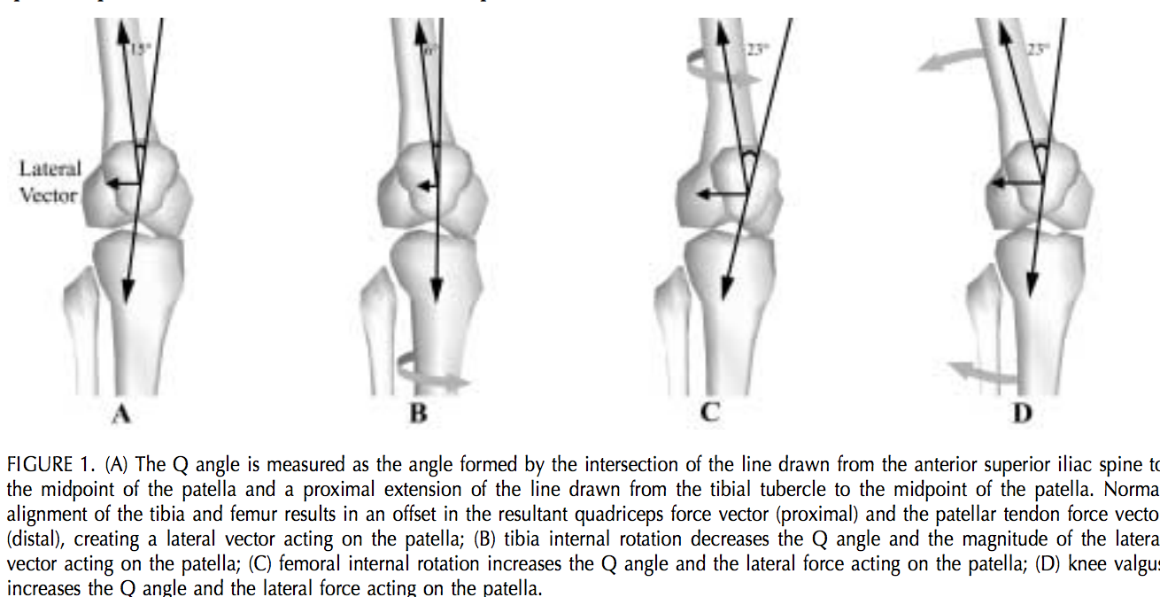 This image was taken from an article published by Chris Powers, PhD, PT, JOSPT 2003