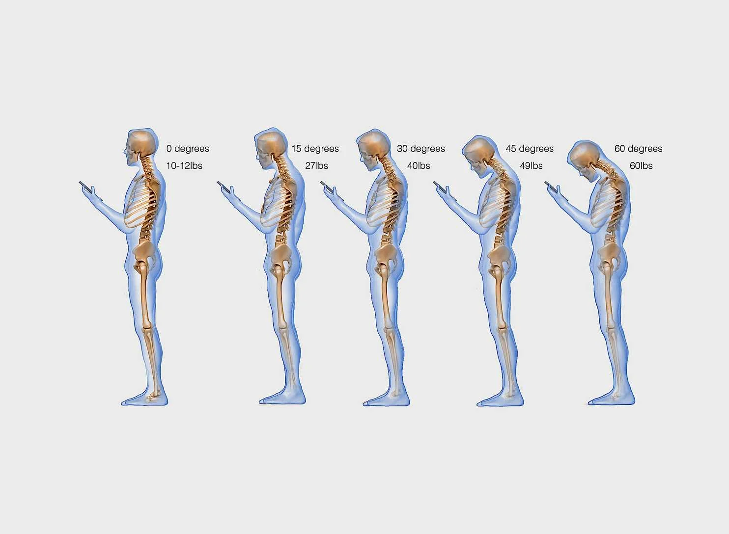 Text neck...what the hell!?! Stop this. 