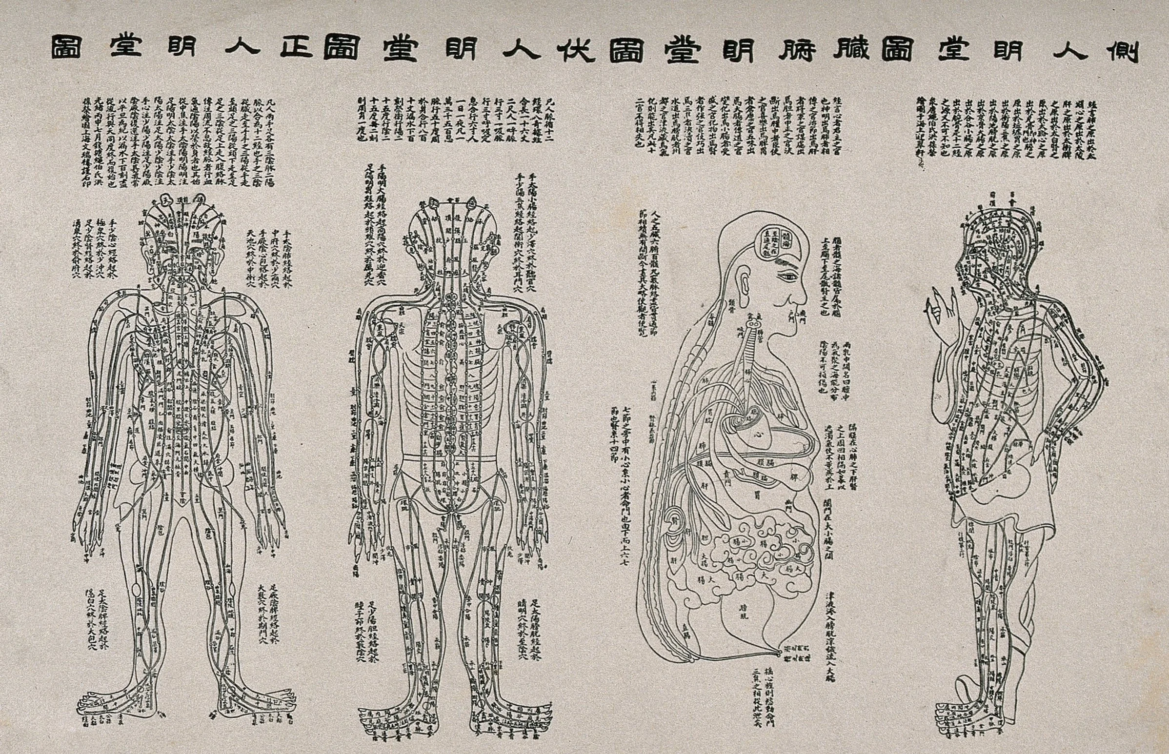 Acupuncture_figures_Wellcome_V0018479.jpg