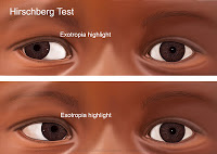 hirschbergtest125.jpg