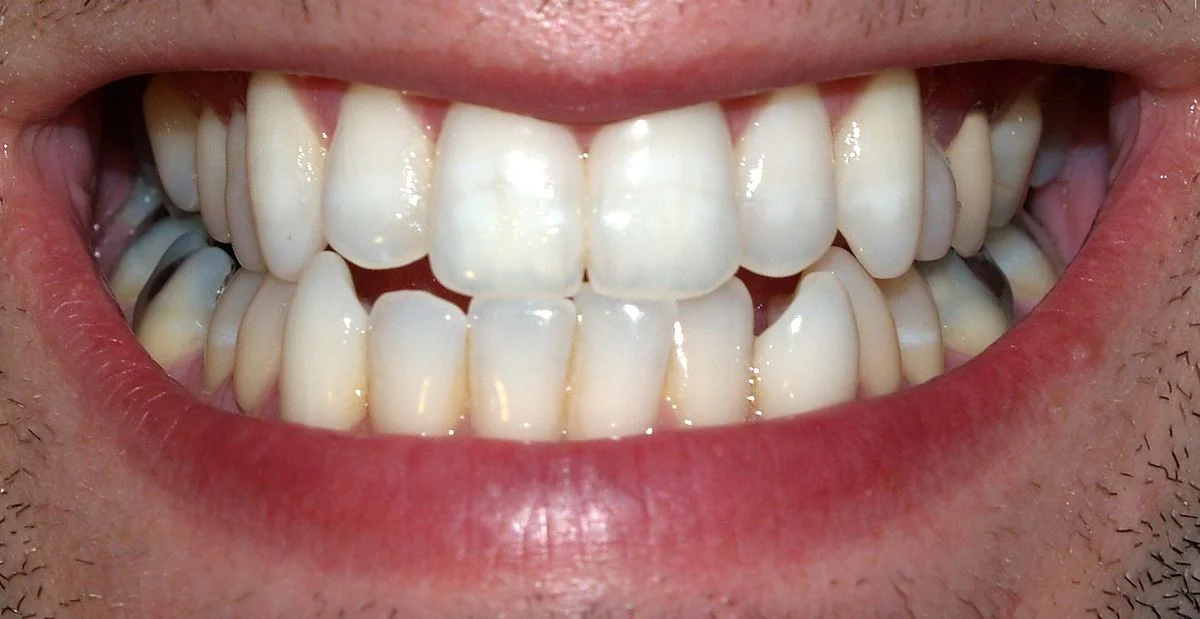 Teeth_by_David_Shankbone.jpg