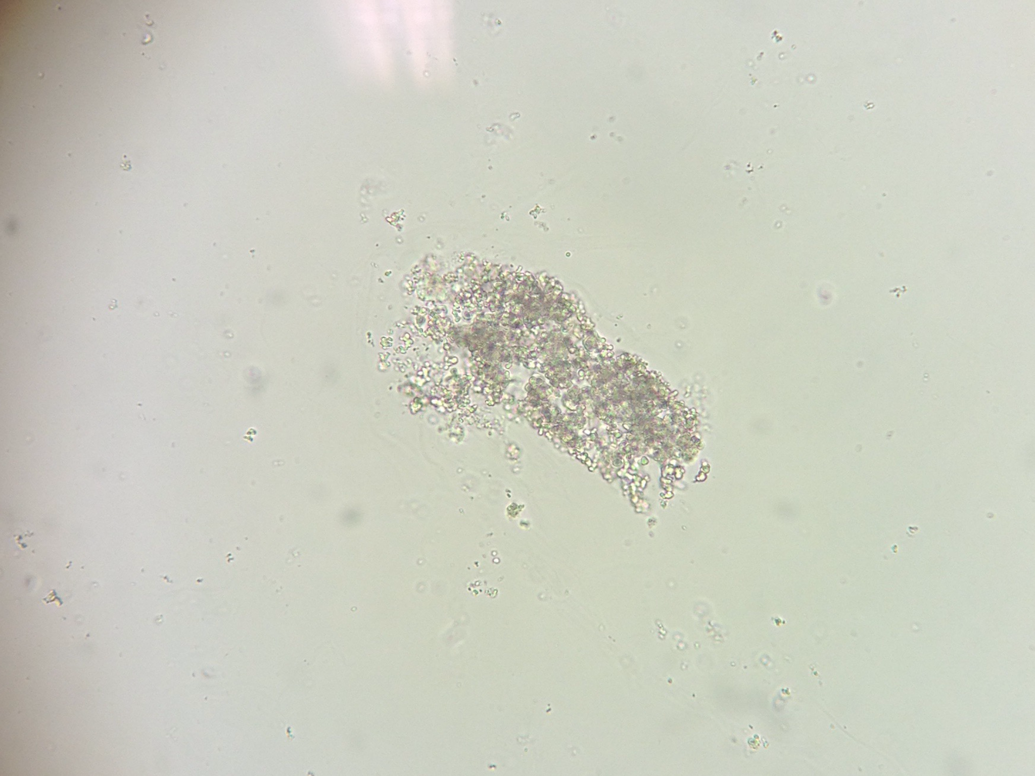 amorphous urates in urine