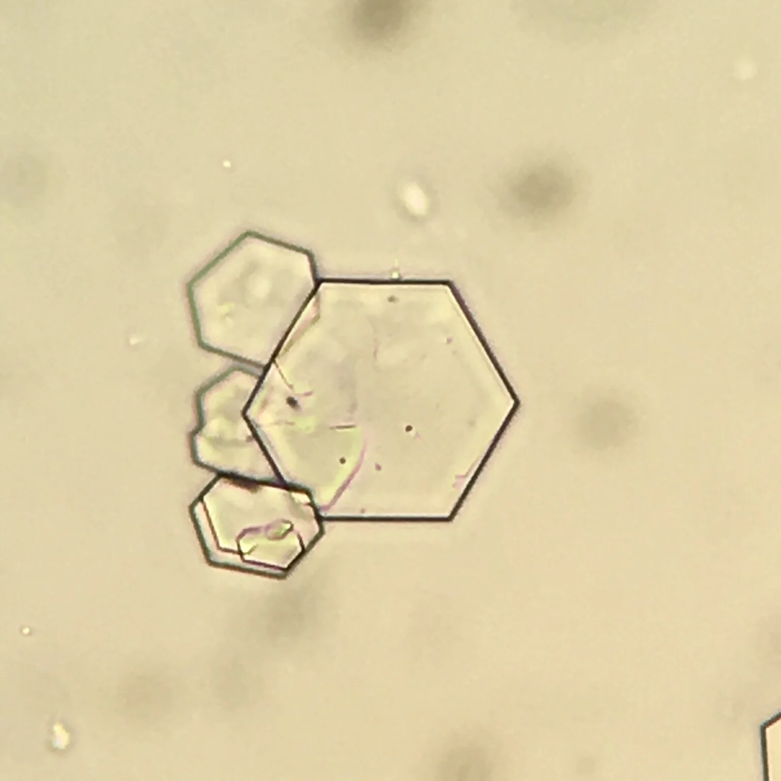 Cystine Crystal Gallery — swissnephro