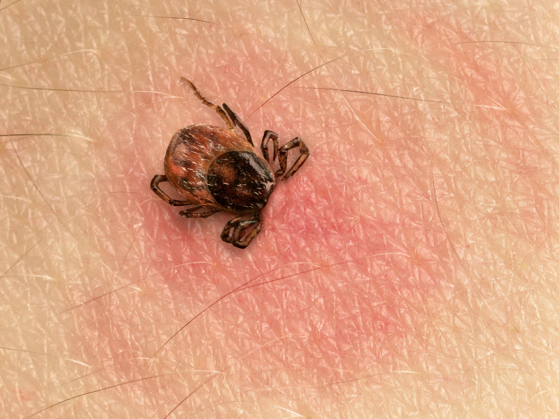 A black-legged tick, or deer tick, can give a person more than one tick-borne disease. (istock)