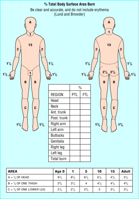 Paediatric Burns Chart