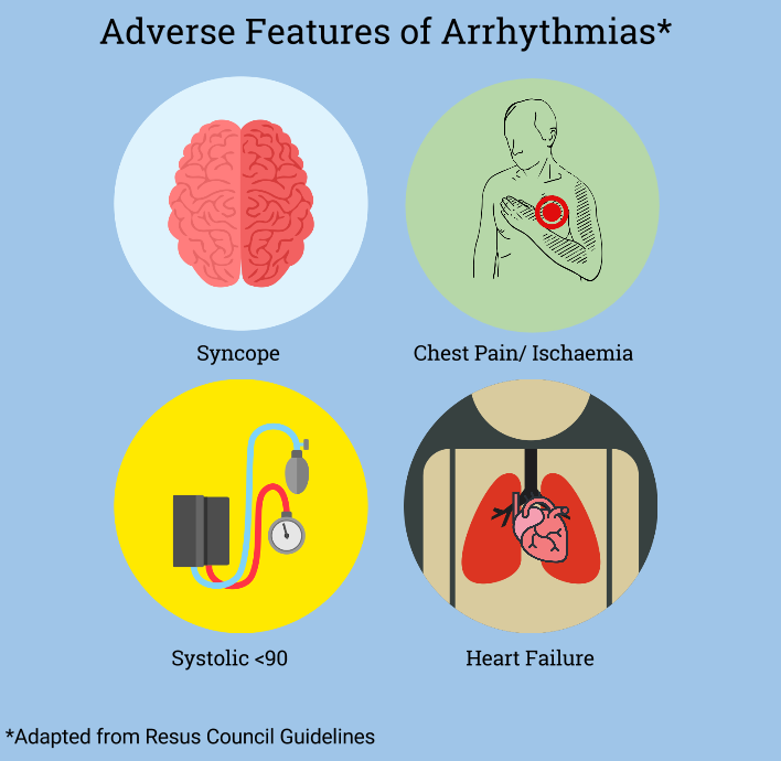 Adverse Features of Arrythmia (1).png