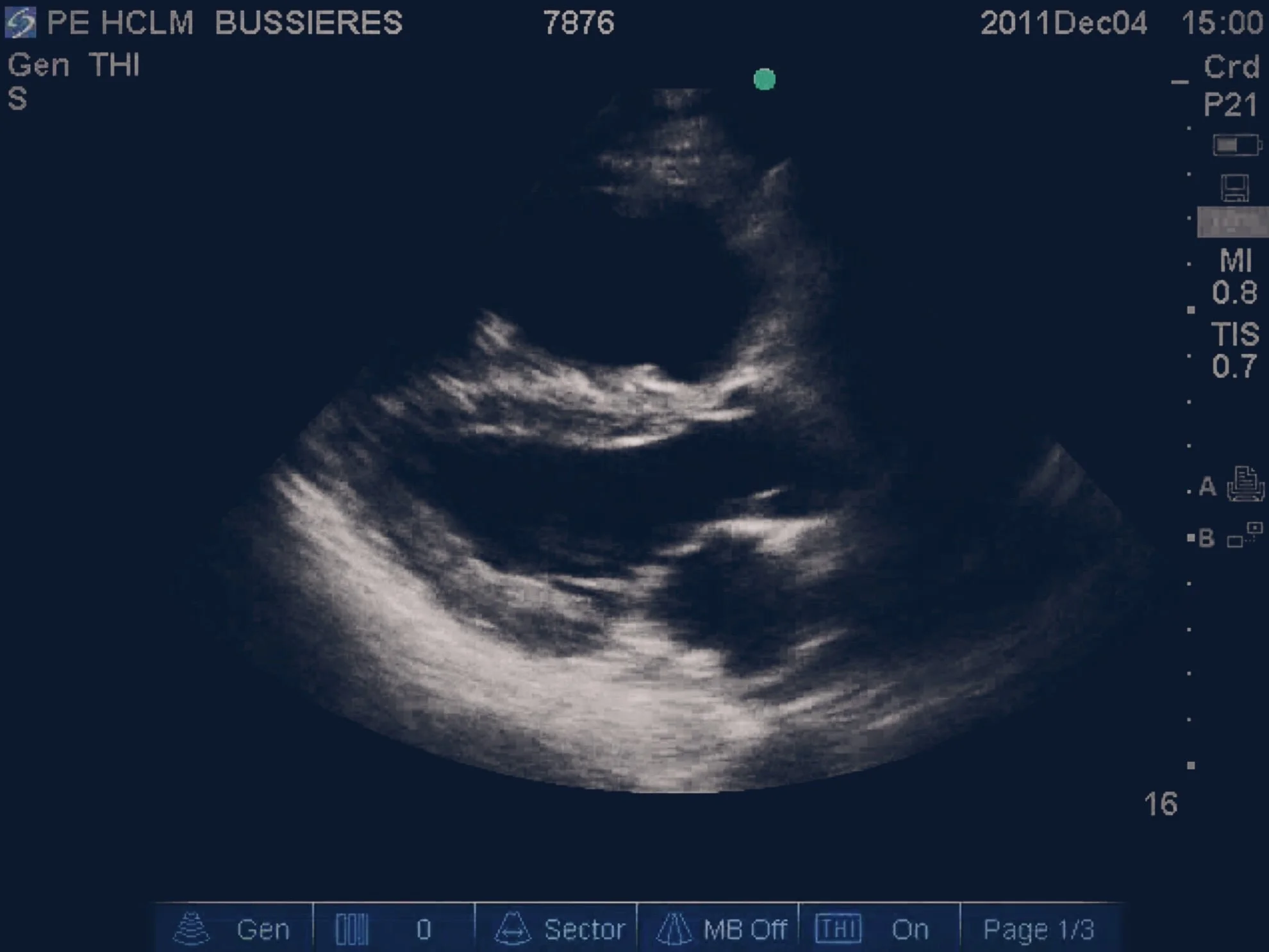 #SimBlog: Sepsis Mimics