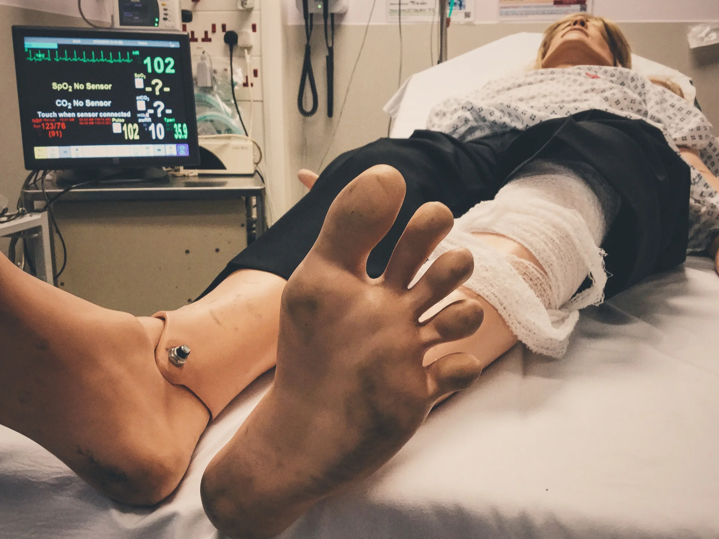 #SimBlog: Hypoglycaemia
