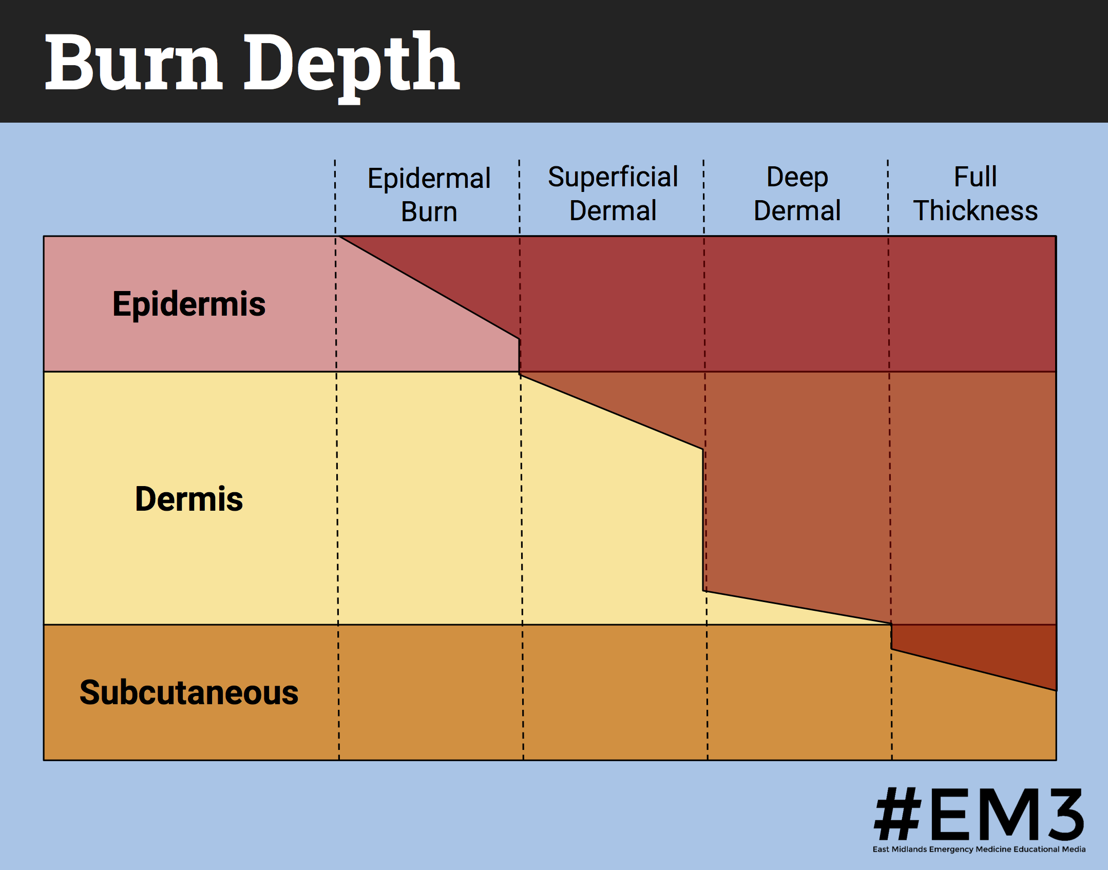 Burn Depth diagram.png