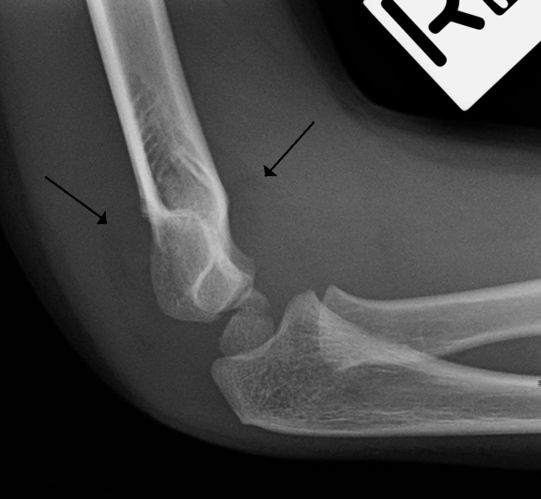 x-ray-1.png