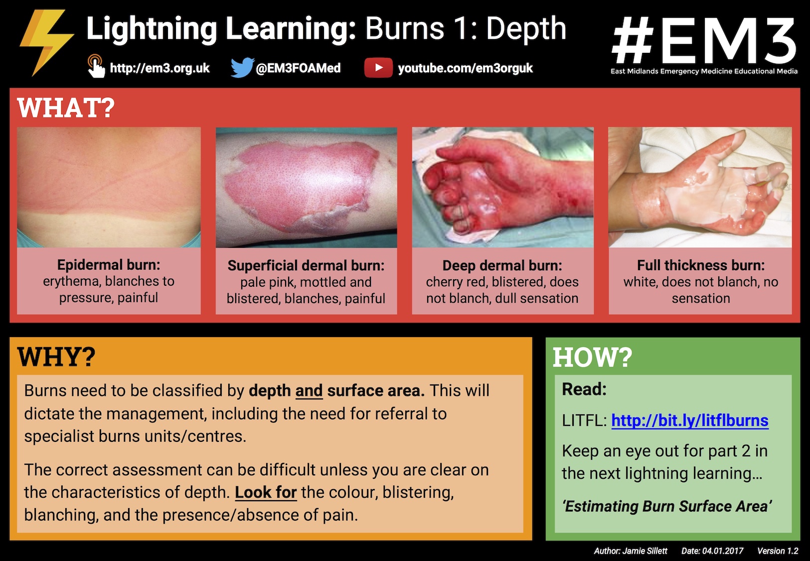 Lightning Learning Burns 1 Depth — Em3