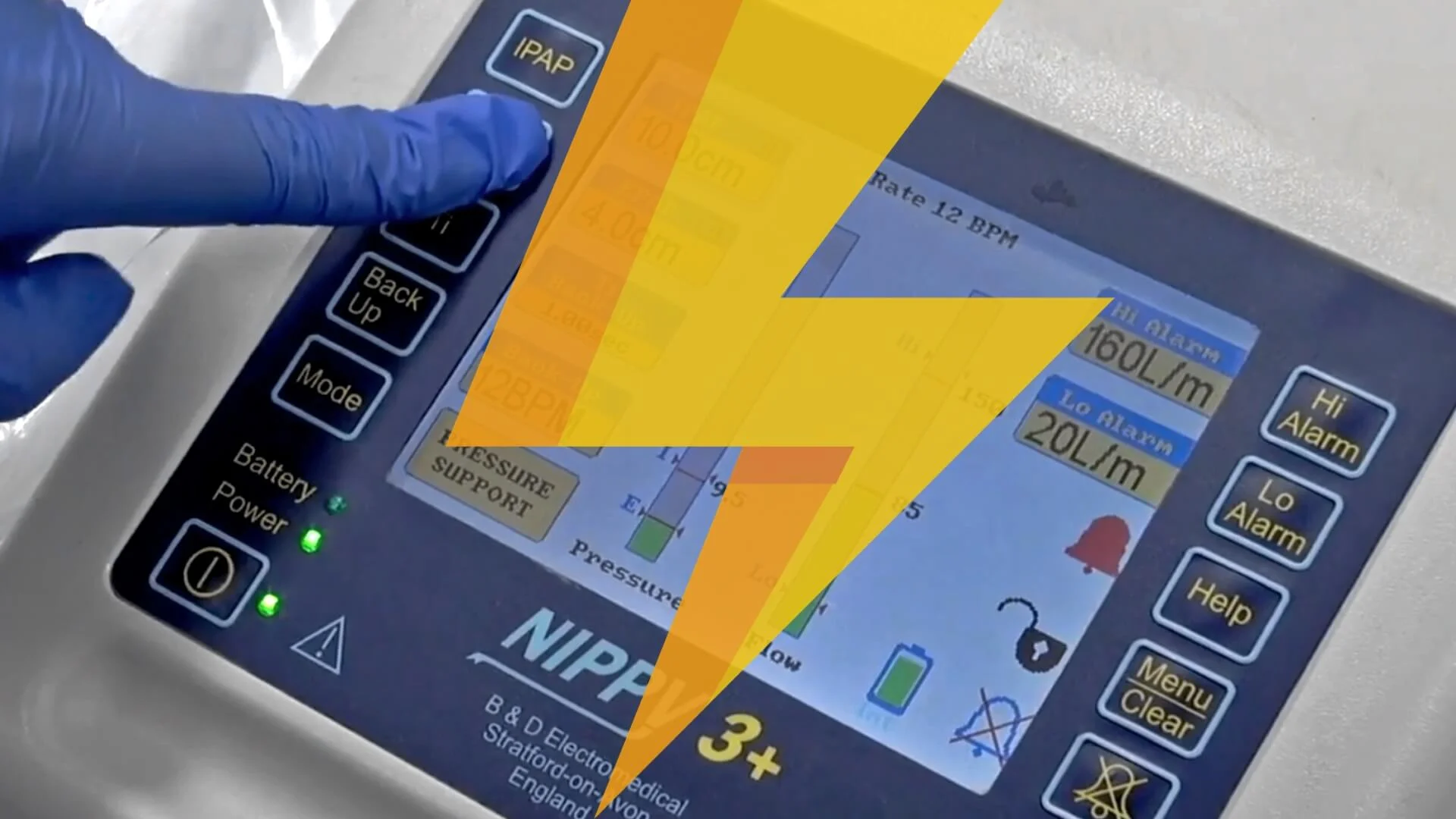 Lightning Learning AHRF Type 2 Respiratory Failure EM3