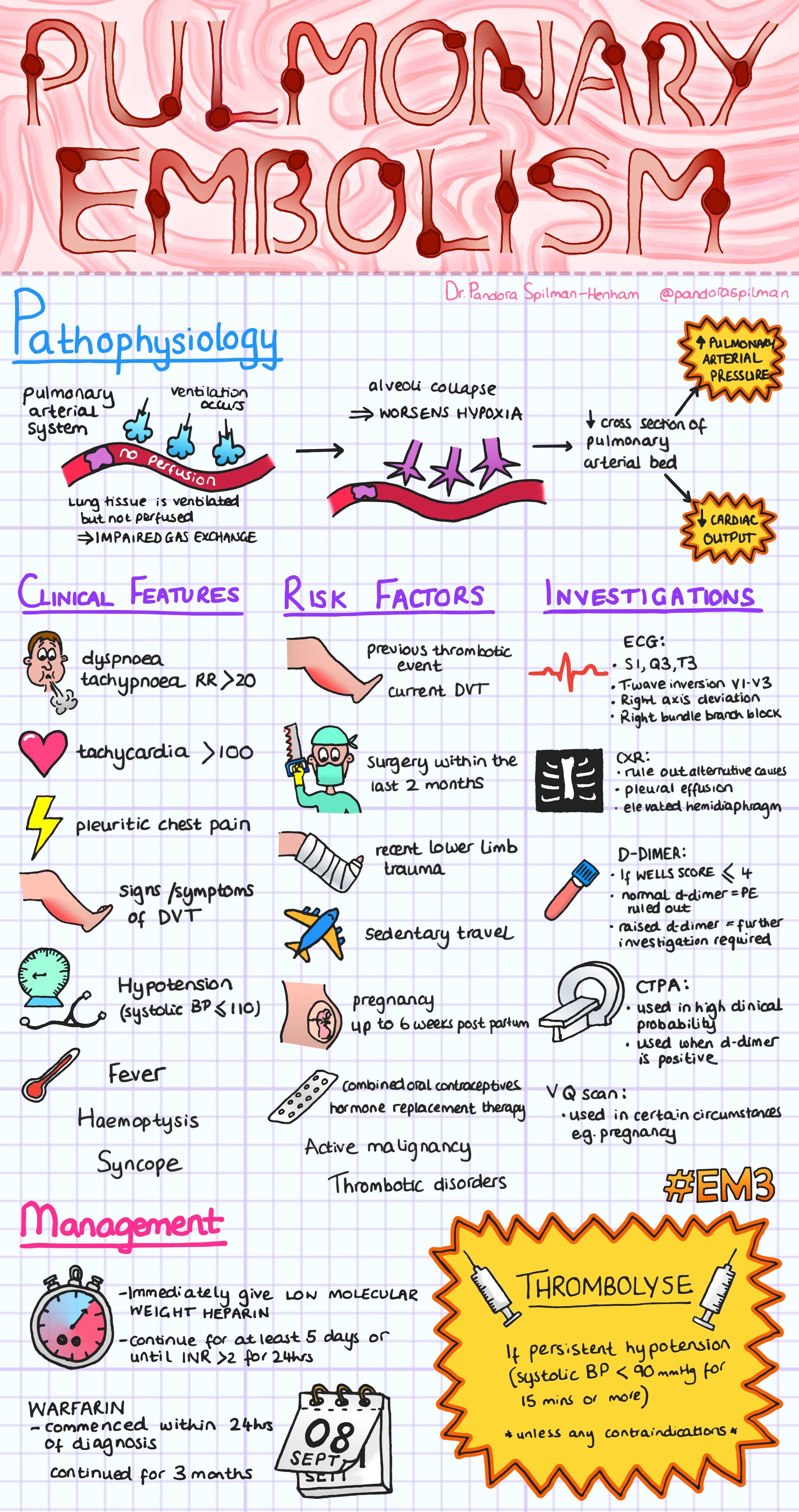 Pulmonary Embolism infographic.jpg