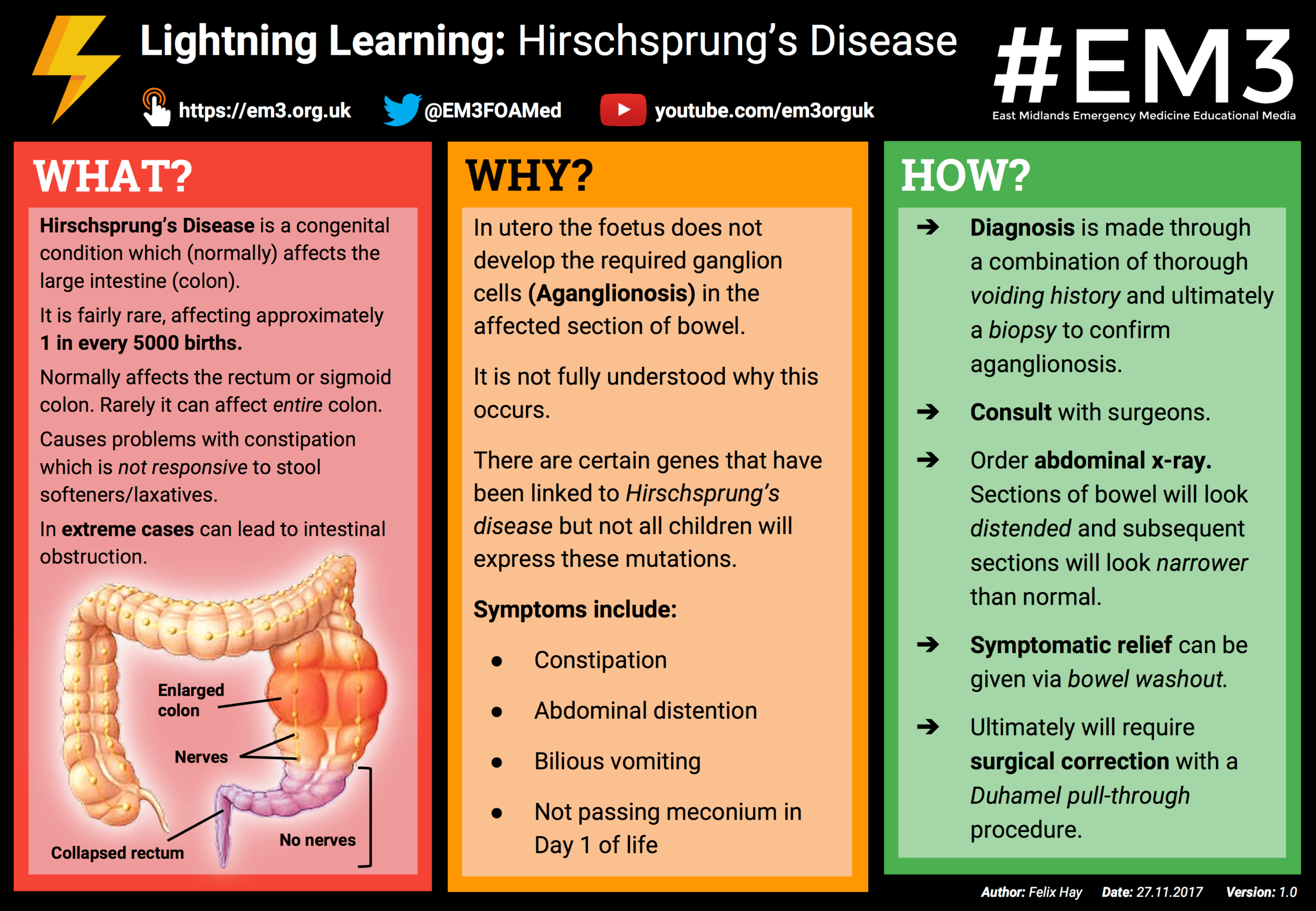Lightning Learning: Hirschsprung's Disease — #EM3: East Midlands