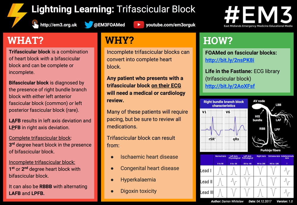 Lightning Learning: Trifascicular Block — EM3