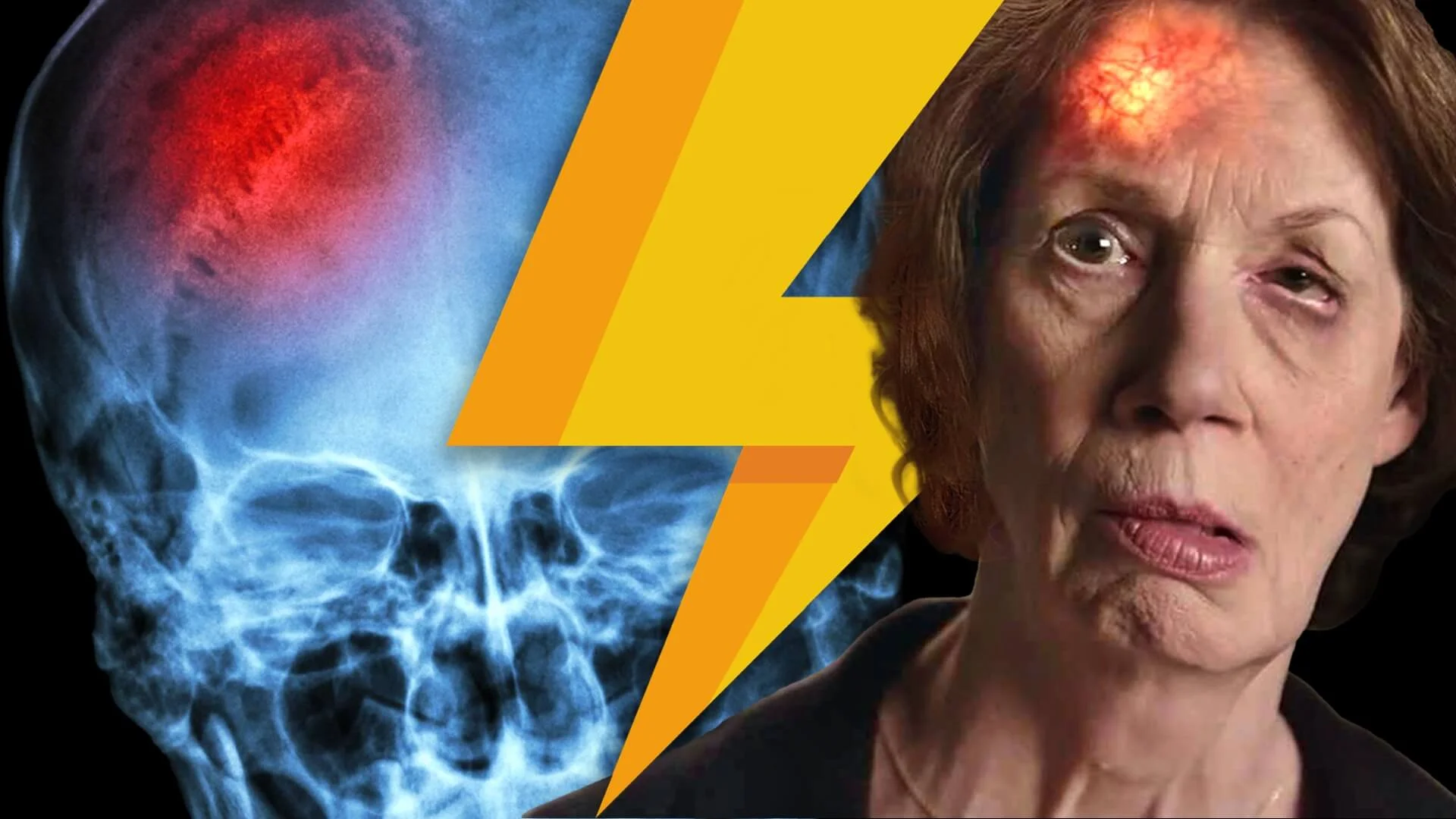 Lightning Learning: ROSIER Score