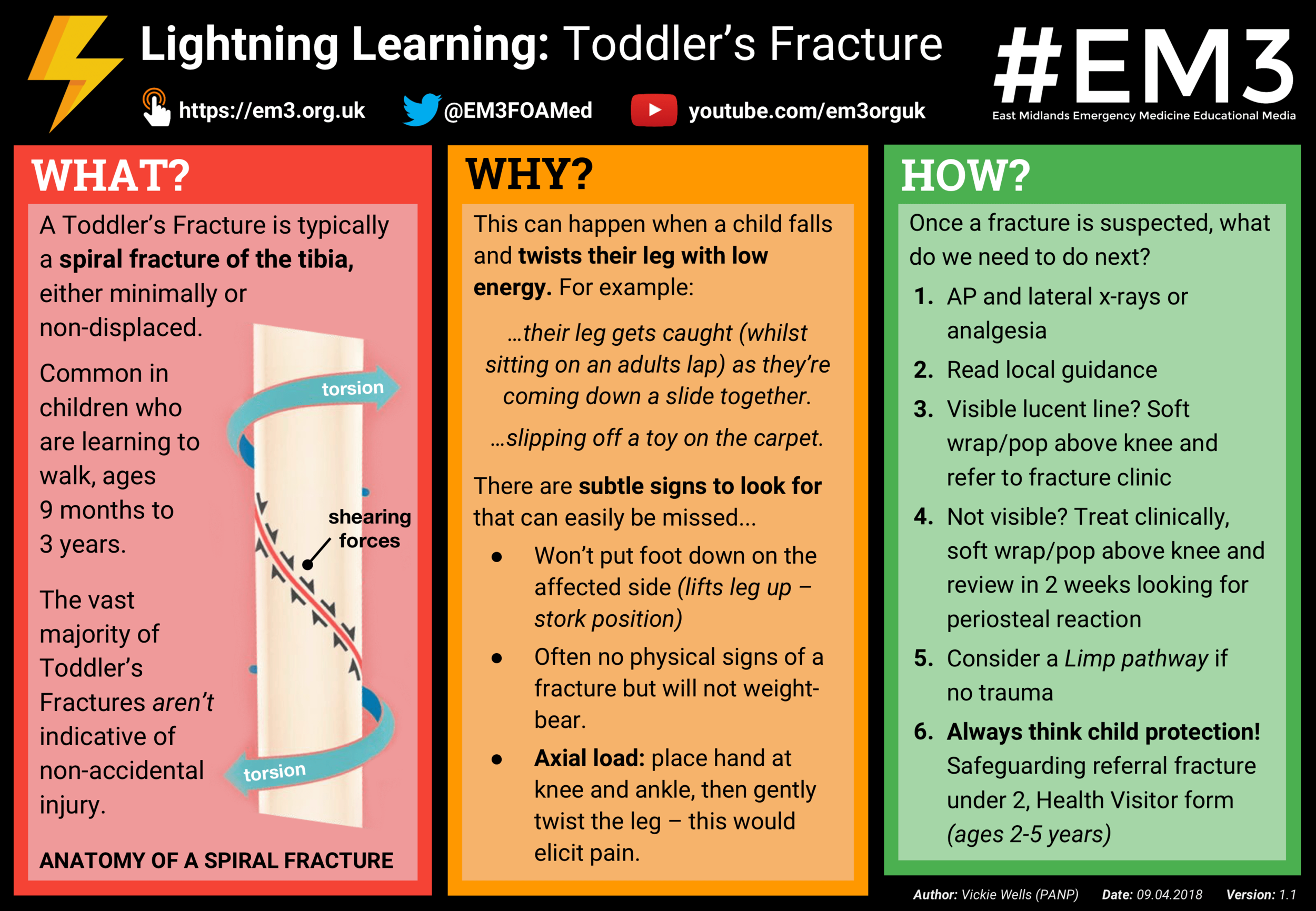 Lightning Learning Toddler's Fracture — EM3
