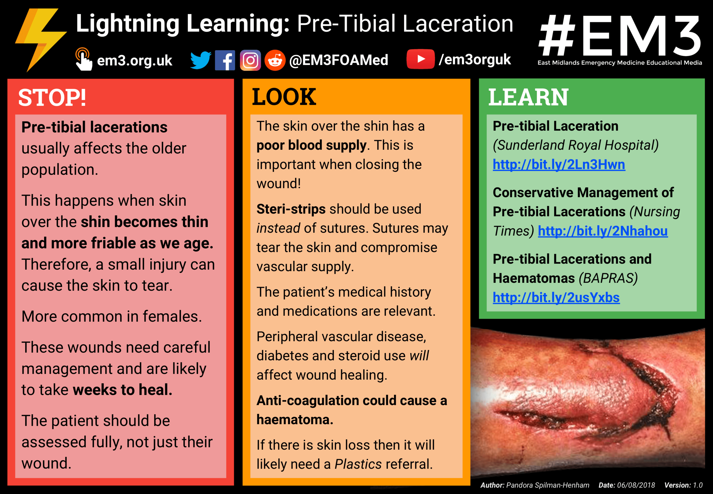 Lightning Learning - Pre-Tibial Laceration.png