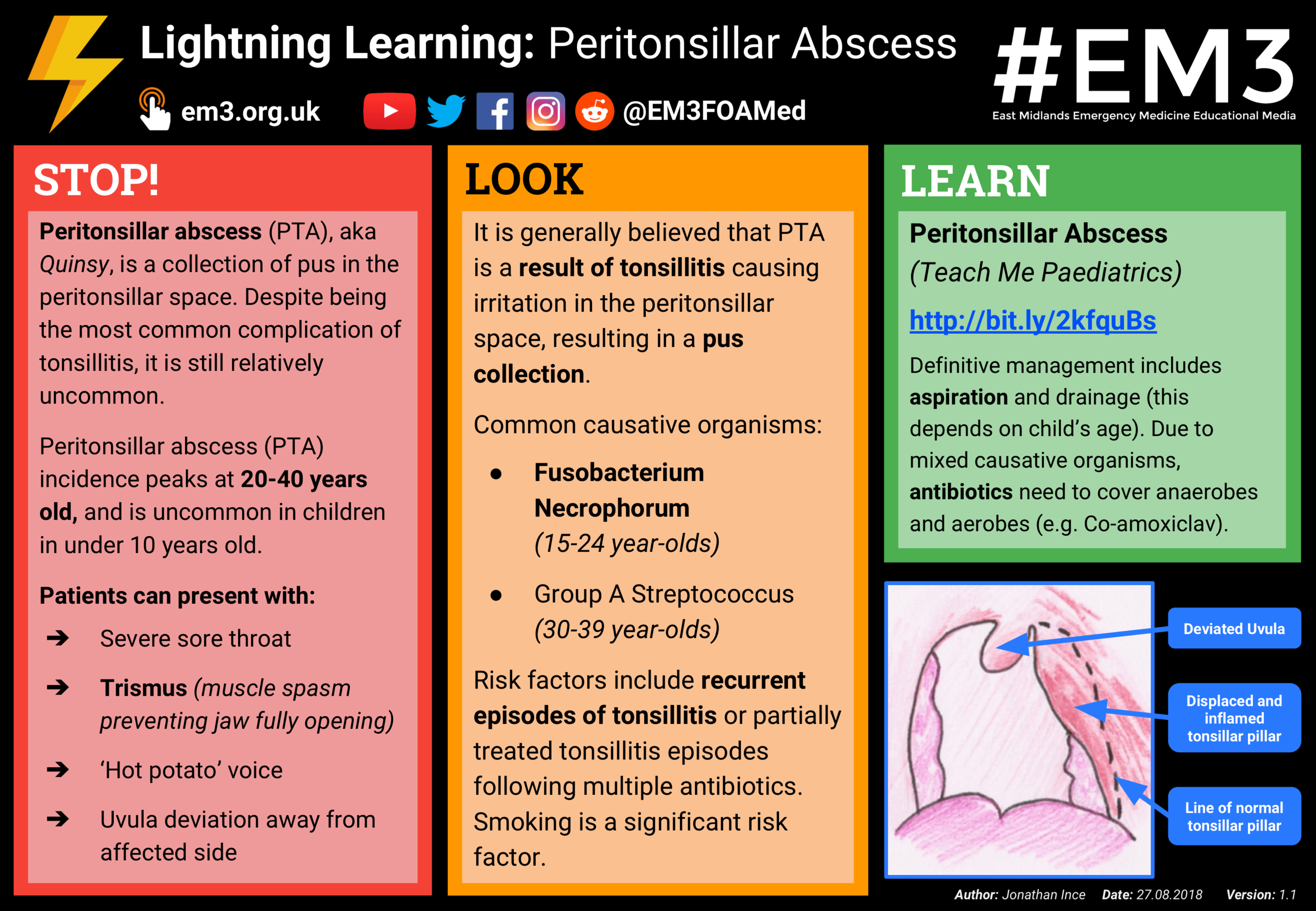 Lightning Learning - Peritonsillar Abscess.png