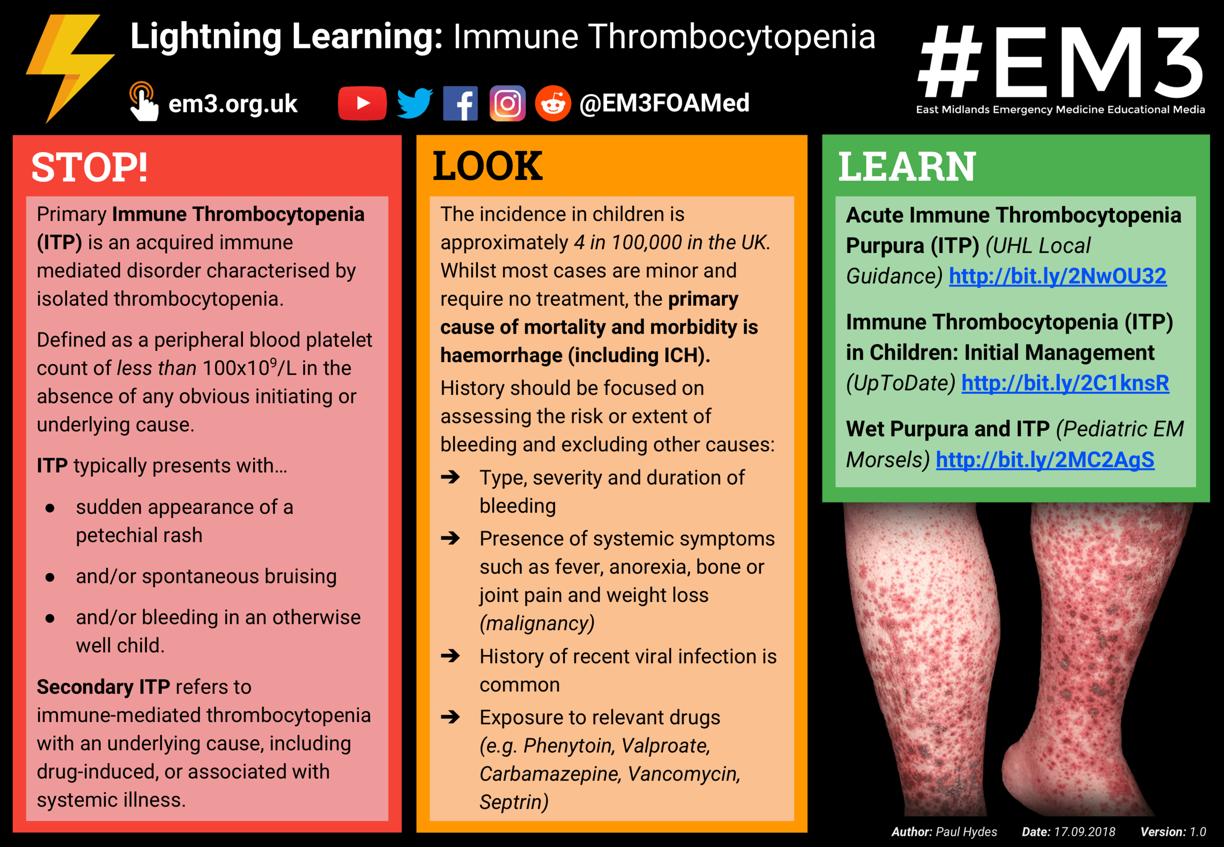 Lightning Learning Immune Thrombocytopenia Itp — Em3