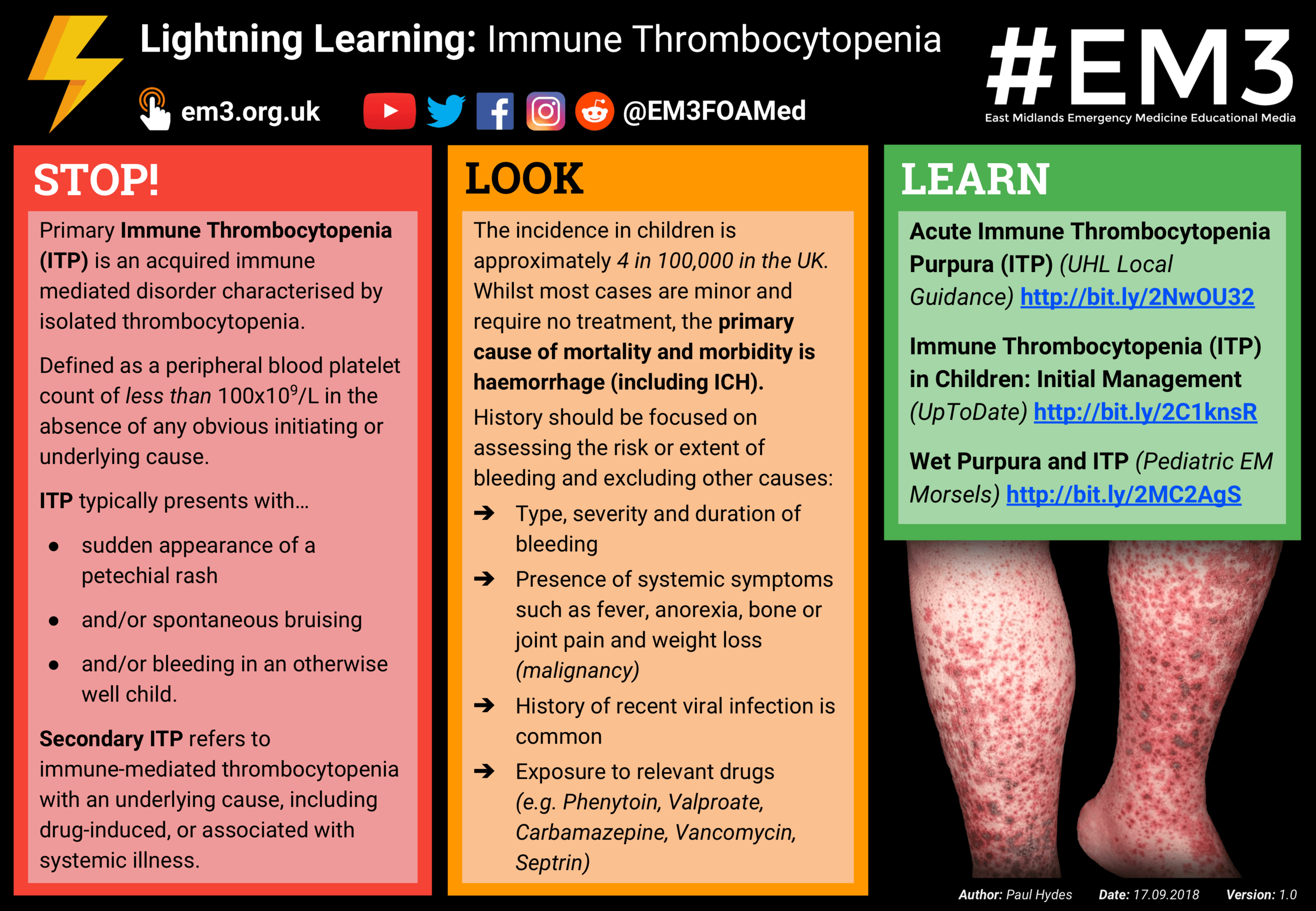 Lightning Learning - Immune Thrombocytopenia (ITP).png