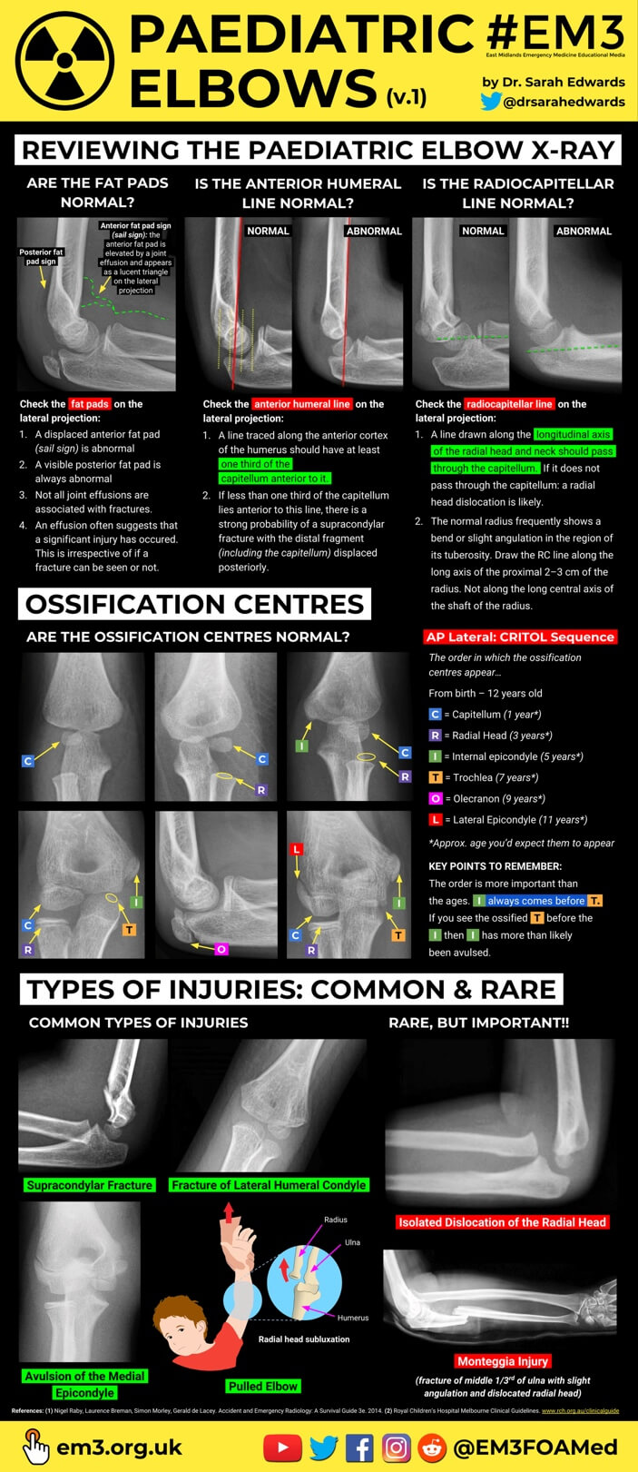 Paediatric Elbow Injuries v.1 (thumbnail).jpg