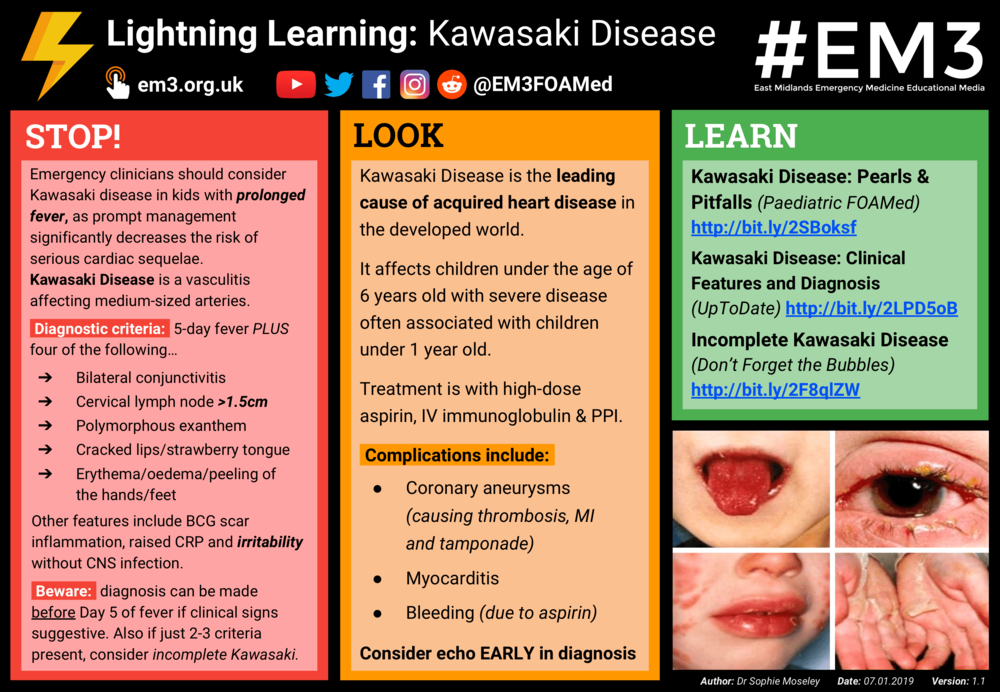 Seaside kuvert Åben Lightning Learning: Kawasaki Disease — #EM3: East Midlands Emergency  Medicine Educational Media