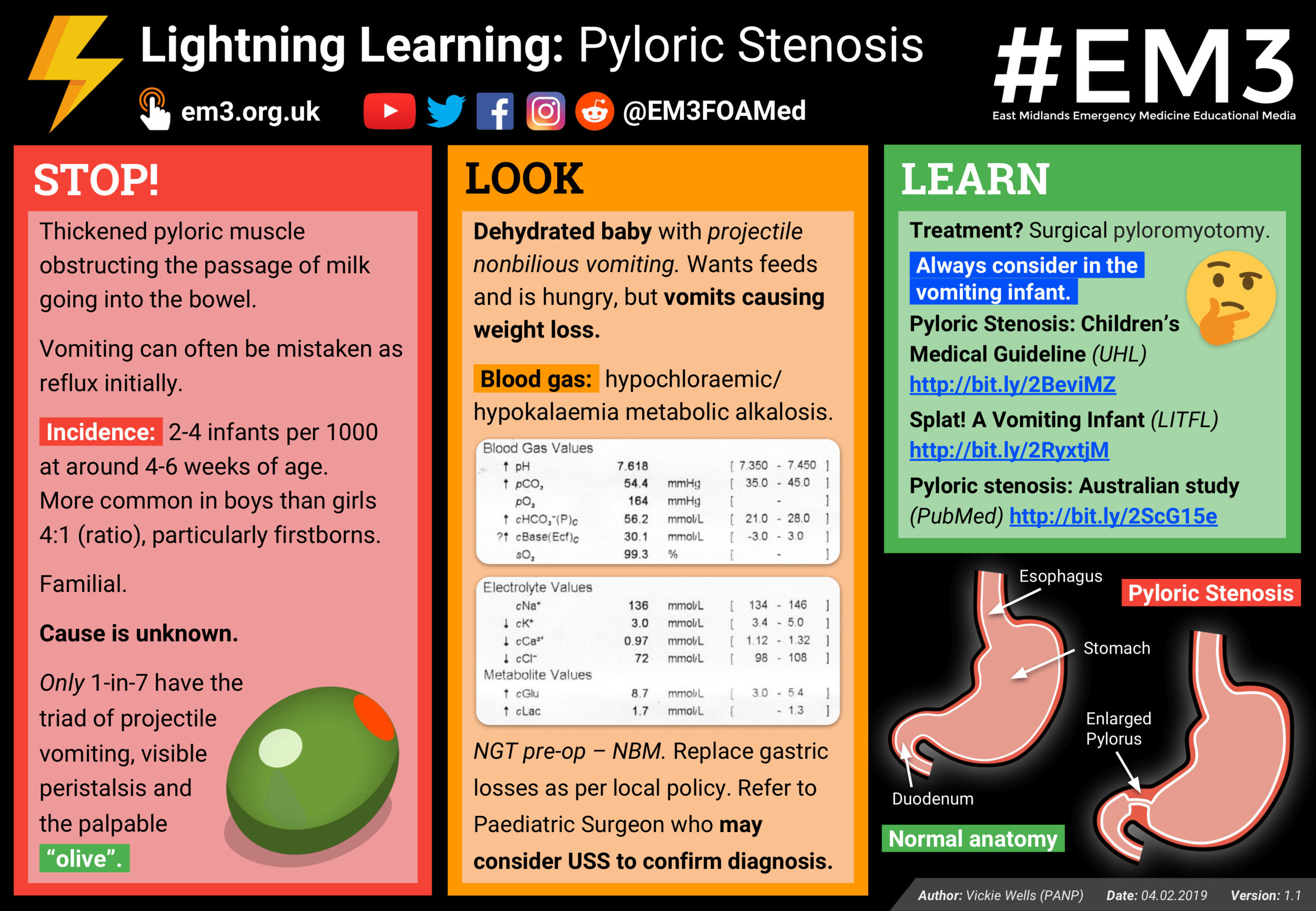 Lightning Learning: Pyloric Stenosis — #EM3: East Midlands Emergency