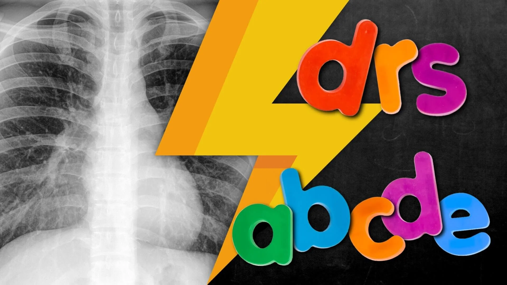 Lightning Learning: Basic Chest X-rays in Adults